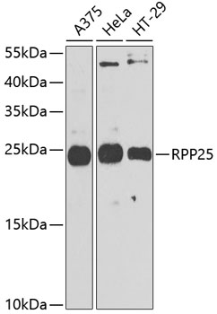 RPP25 Polyclonal Antibody