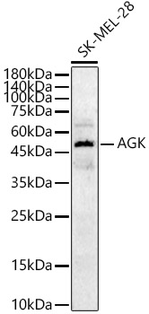 AGK Polyclonal Antibody&nbsp;<img src="images/icon_newarrival.gif" alt="new" border="0">