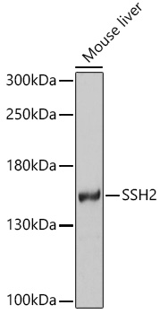 SSH2 Polyclonal Antibody