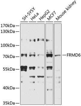 FRMD6 Polyclonal Antibody