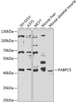 PABPC5 Polyclonal Antibody