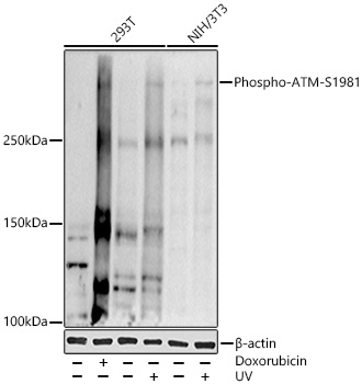 Phospho-ATM-S1981 Polyclonal Antibody