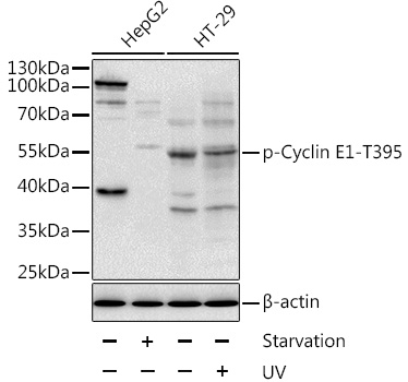 Phospho-Cyclin E1-T395 Polyclonal Antibody