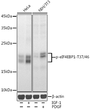 Phospho-eIF4EBP1-T37/46 Polyclonal Antibody