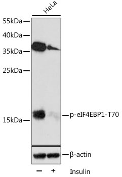 Phospho-eIF4EBP1-T70 Polyclonal Antibody