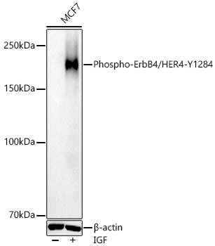 Phospho-ErbB4/HER4-Y1284 Polyclonal Antibody