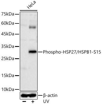 Phospho-HSP27/HSPB1-S15 Polyclonal Antibody