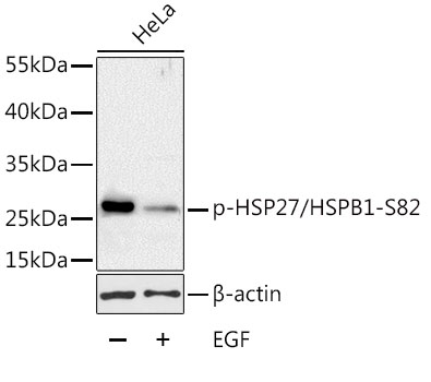 Phospho-HSP27/HSPB1-S82 Polyclonal Antibody