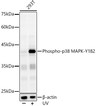 Phospho-p38 MAPK-Y182 Polyclonal Antibody