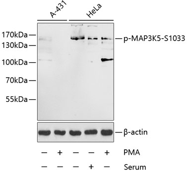 Phospho-MAP3K5-S1033 Polyclonal Antibody