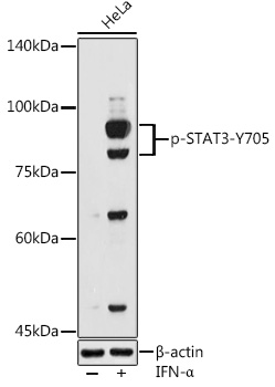 Phospho-STAT3-Y705 Polyclonal Antibody