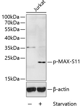 Phospho-MAX-S11 Polyclonal Antibody