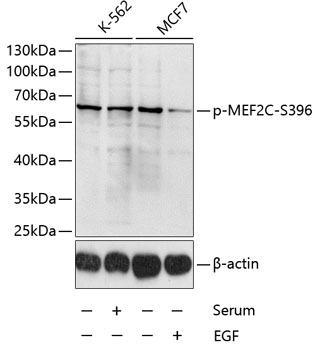 Phospho-MEF2C-S396 Polyclonal Antibody