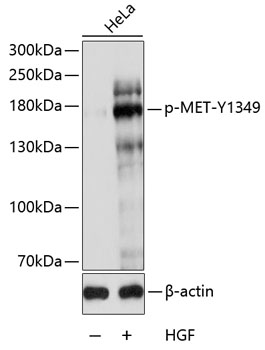 Phospho-MET-Y1349 Polyclonal Antibody