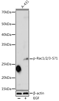 Phospho-Rac1/2/3-S71 Polyclonal Antibody