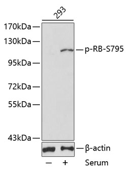 Phospho-RB-S795 Polyclonal Antibody