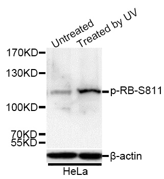 Phospho-RB-S811 Polyclonal Antibody