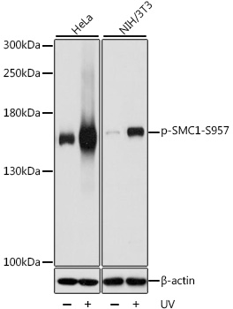 Phospho-SMC1-S957 Polyclonal Antibody