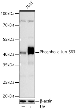 Phospho-c-Jun-S63 Monoclonal Antibody [7A7K1]