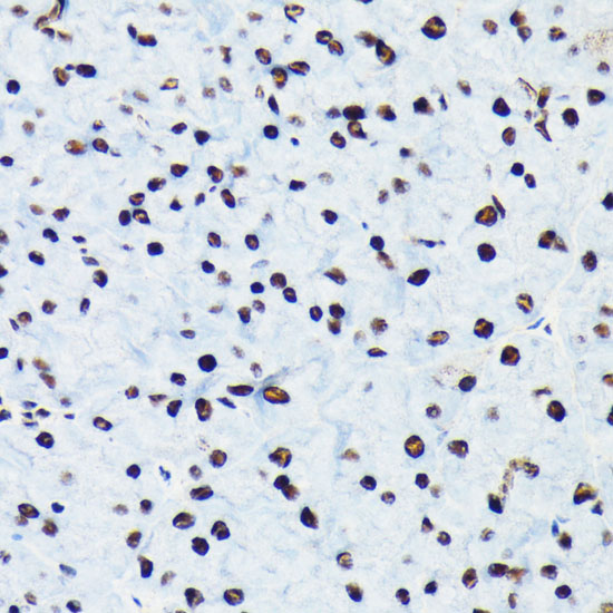 Phospho-RB-S780 Monoclonal Antibody
