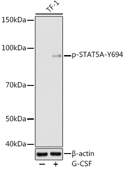 Phospho-STAT5A-Y694 Polyclonal Antibody