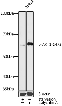 Phospho-AKT1-S473 Polyclonal Antibody