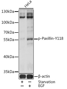Phospho-Paxillin-Y118 Polyclonal Antibody