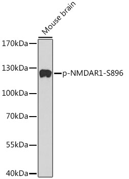 Phospho-NMDAR1-S896 Polyclonal Antibody