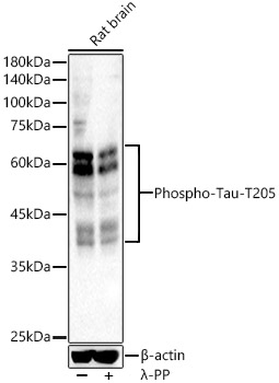 Phospho-Tau-T205 Polyclonal Antibody
