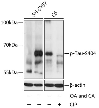 Phospho-Tau-S404 Polyclonal Antibody