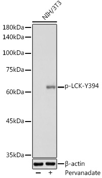 Phospho-LCK-Y394 Polyclonal Antibody
