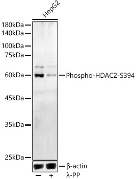 Phospho-HDAC2-S394 Polyclonal Antibody