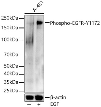 Phospho-EGFR-Y1172 Polyclonal Antibody