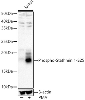 Phospho-Stathmin 1-S25 Polyclonal Antibody