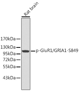 Phospho-GluR1/GRIA1-S849 Polyclonal Antibody