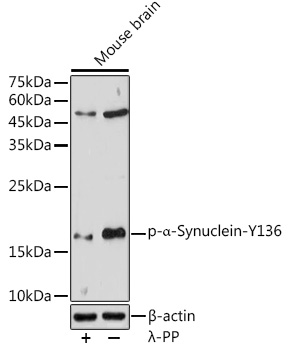 Phospho-a-Synuclein-Y136 Polyclonal Antibody