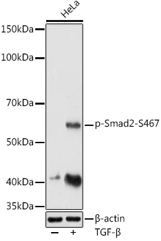 Phospho-Smad2-S467 Polyclonal Antibody