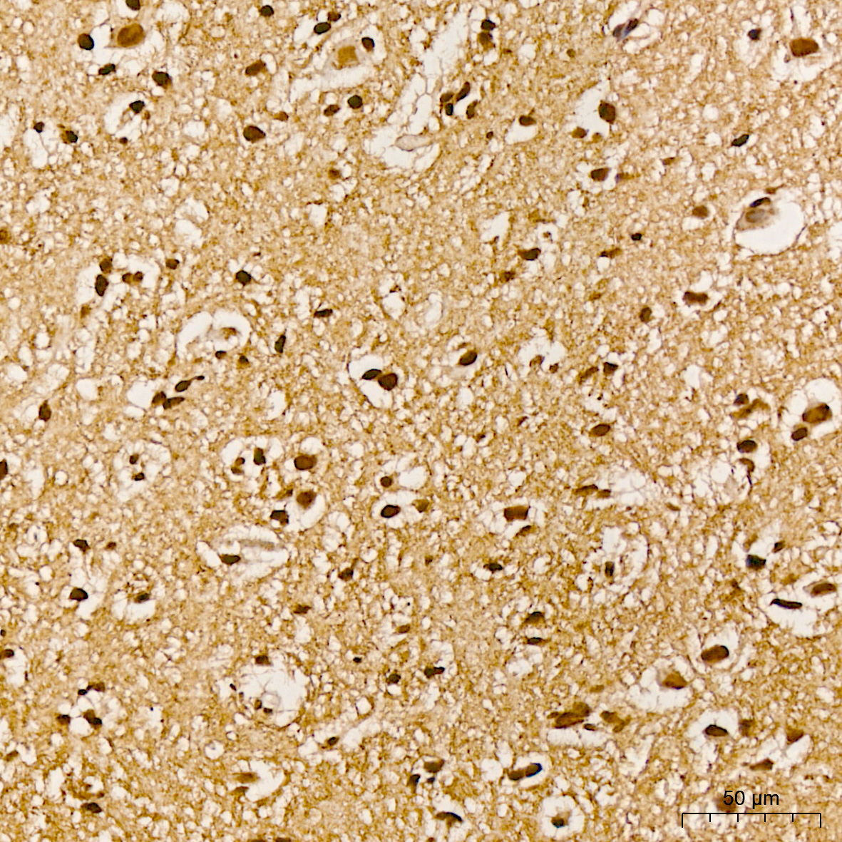 Phospho-Akt-Y315 Polyclonal Antibody