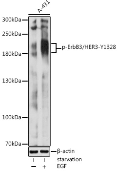 Phospho-ErbB3/HER3-Y1328 Polyclonal Antibody