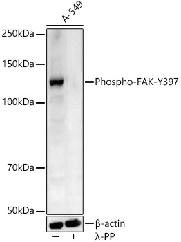 Phospho-FAK-Y397 Polyclonal Antibody