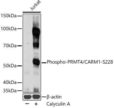 Phospho-PRMT4/CARM1-S228 Polyclonal Antibody