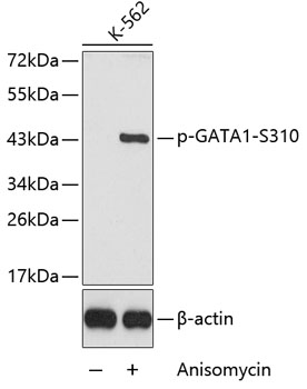 Phospho-GATA1-S310 Polyclonal Antibody