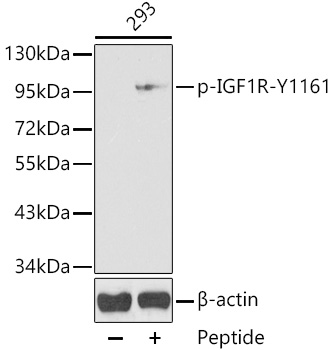 Phospho-IGF1R-Y1161 Polyclonal Antibody
