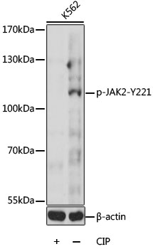 Phospho-JAK2-Y221 Polyclonal Antibody