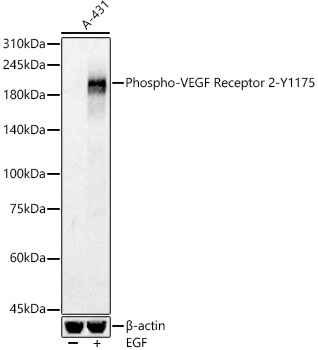 Phospho-VEGF Receptor 2-Y1175 Polyclonal Antibody