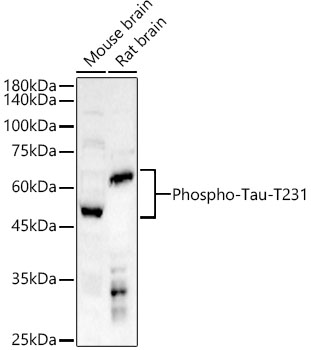 Phospho-Tau-T231 Polyclonal Antibody