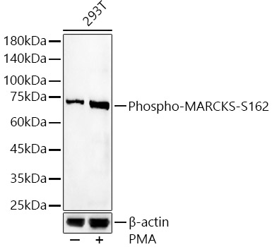 Phospho-MARCKS-S162 Polyclonal Antibody