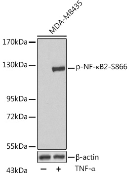 Phospho-NF-kappaB2-S866 Polyclonal Antibody