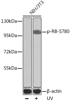 Phospho-RB-S780 Polyclonal Antibody