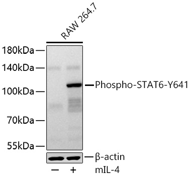 Phospho-STAT6-Y641 Polyclonal Antibody